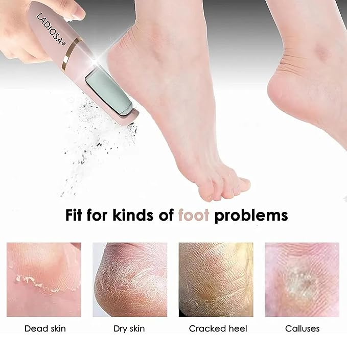 Callus Remover Rechargeable Pedicure Tool for Dead Skin