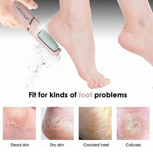 Callus Remover Rechargeable Pedicure Tool for Dead Skin